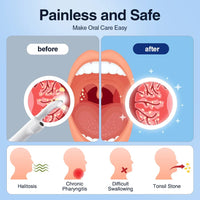 HD Visible Tonsil Stone Removal Vacuum Kit