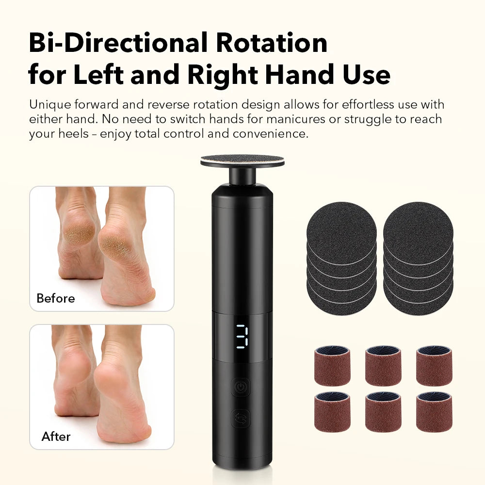 Electric Foot Callus Remover for Smooth & Soft Heels - 41