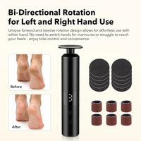 Electric Foot Callus Remover for Smooth & Soft Heels