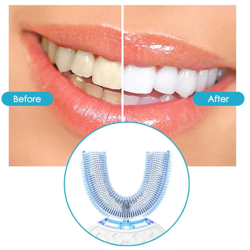 U-Shaped Sonic Electric Toothbrush for Deep Cleaning - 3