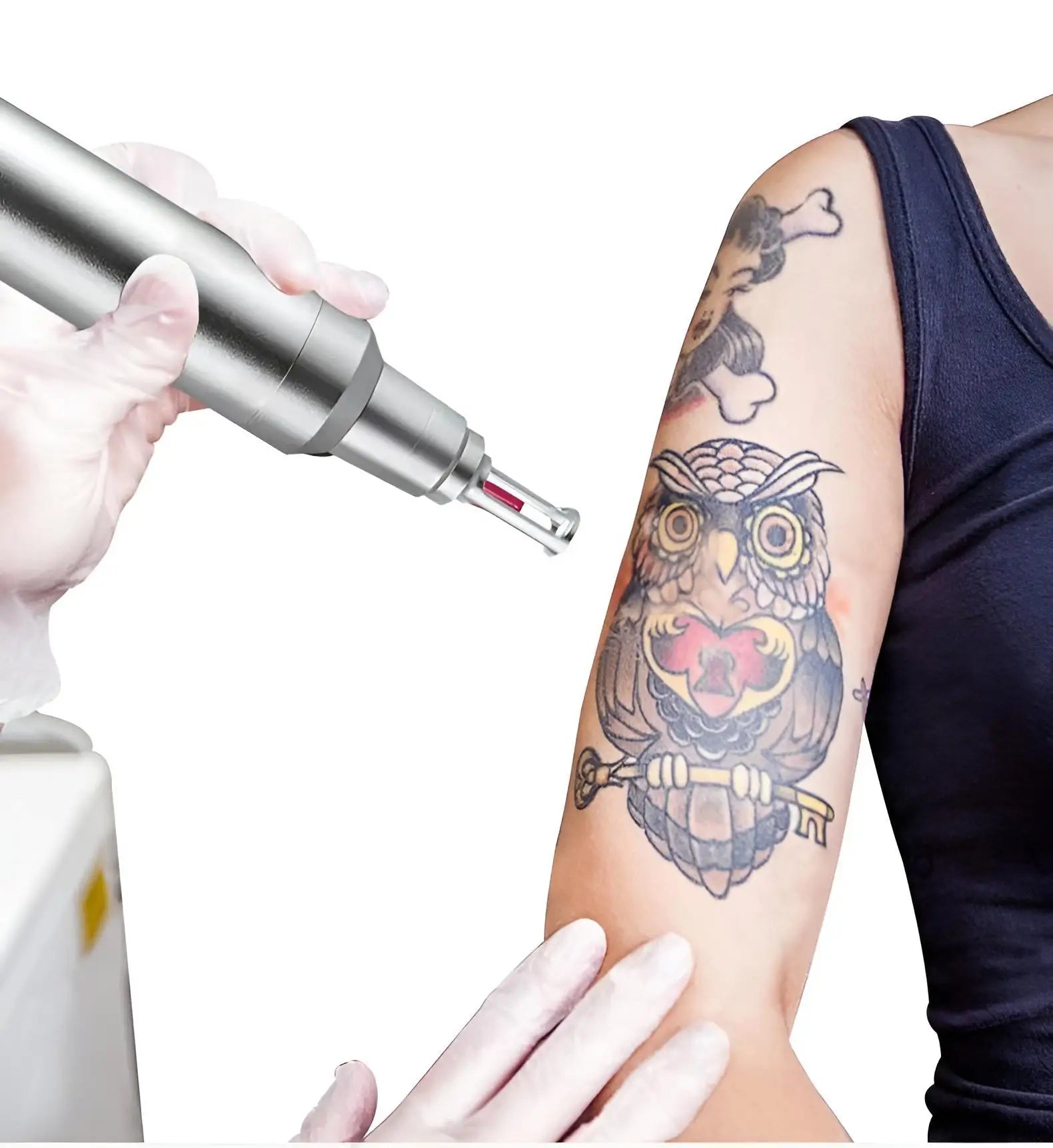 Professional Picosecond Laser Tattoo and Skin Rejuvenation Machine - 20