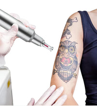 Professional Picosecond Laser Tattoo and Skin Rejuvenation Machine