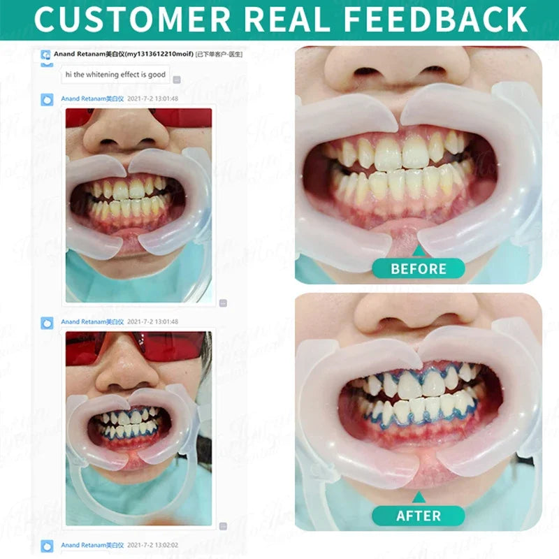 Professional LED Teeth Whitening Accelerator Lamp - 14