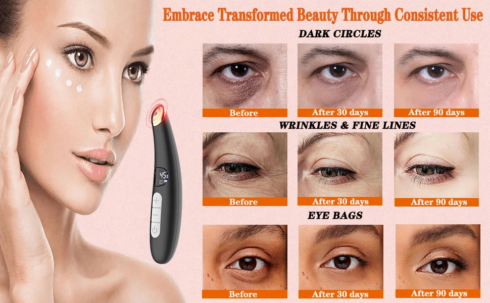 3-in-1 Heated Eye & Face Rejuvenation Wand - 10
