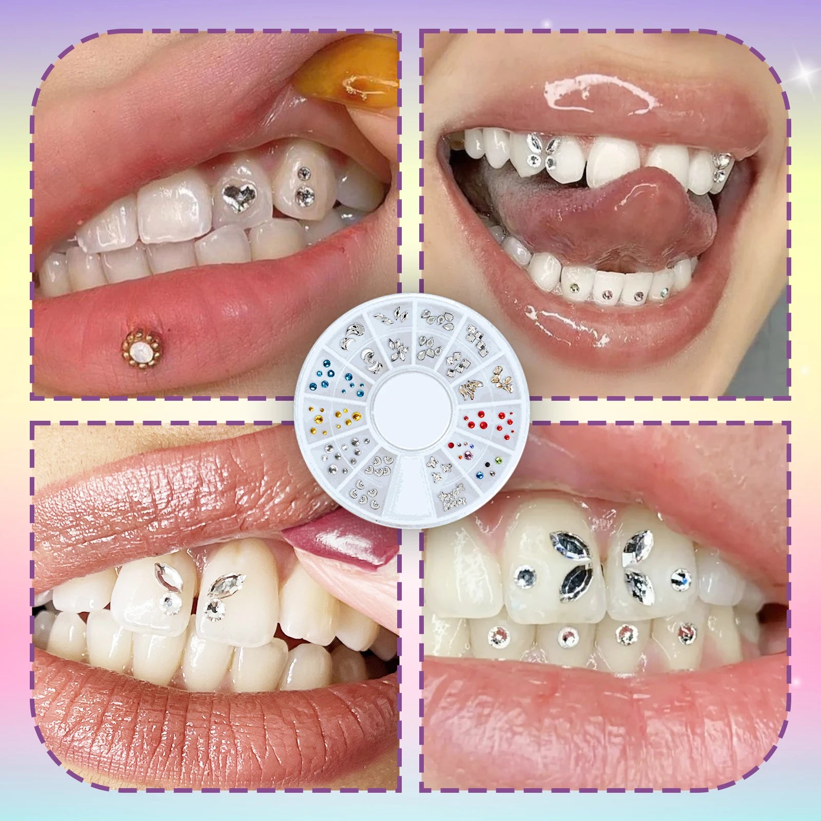 DIY Professional Tooth Gem Kit for a Sparkling Smile - 5