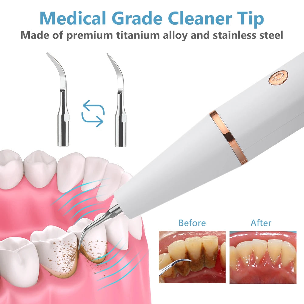 Electric Ultrasonic Teeth Cleaner for Plaque and Tartar Removal - 9