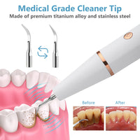 Electric Ultrasonic Teeth Cleaner for Plaque and Tartar Removal