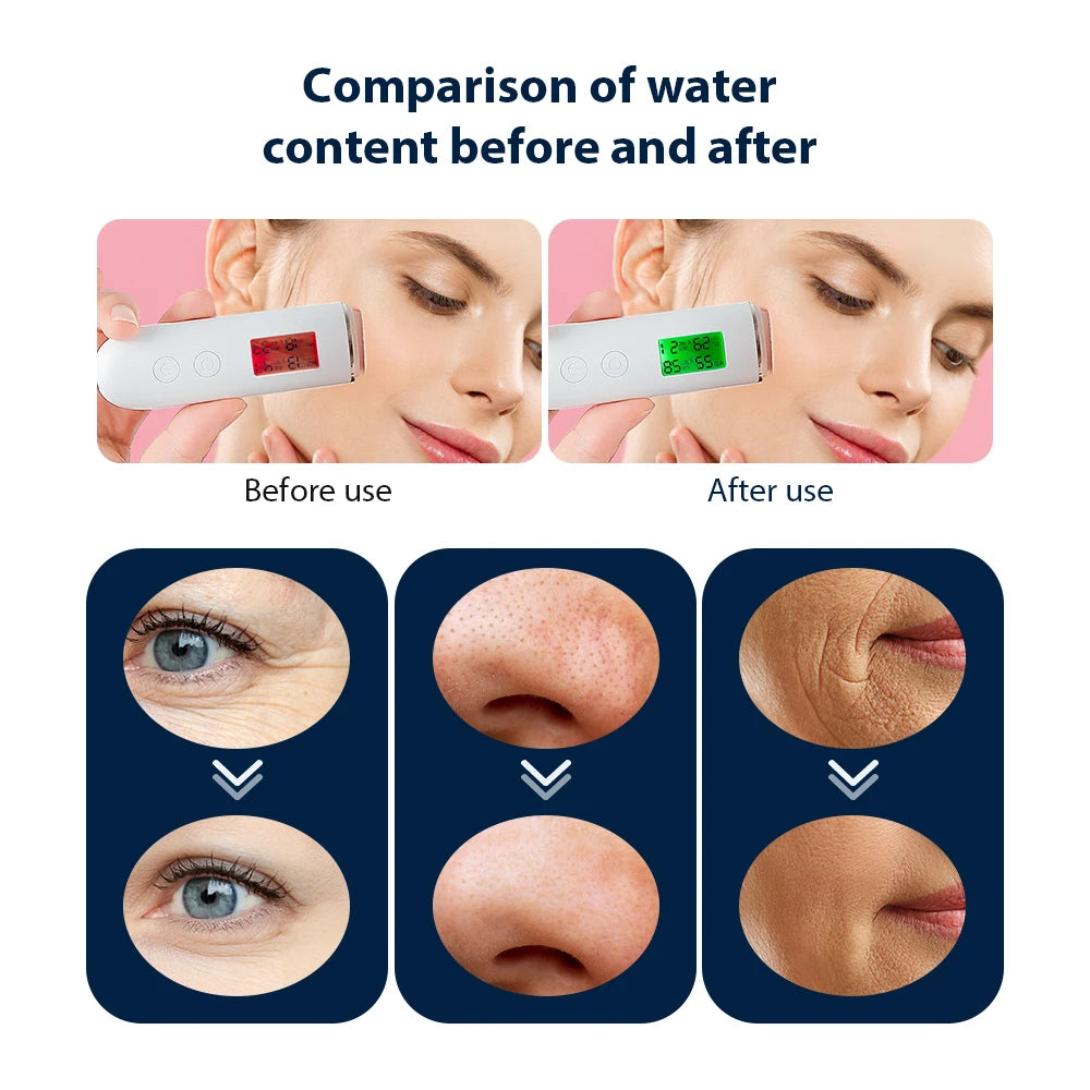 Portable Oxygen Bubble Facial Spa Device - 18