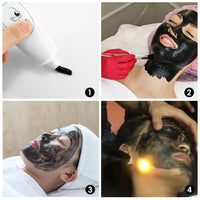 Carbon Laser Facial Resurfacing Gel for Deep Pore Cleansing