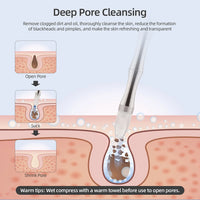 3-in-1 Professional Diamond Microdermabrasion Facial Machine