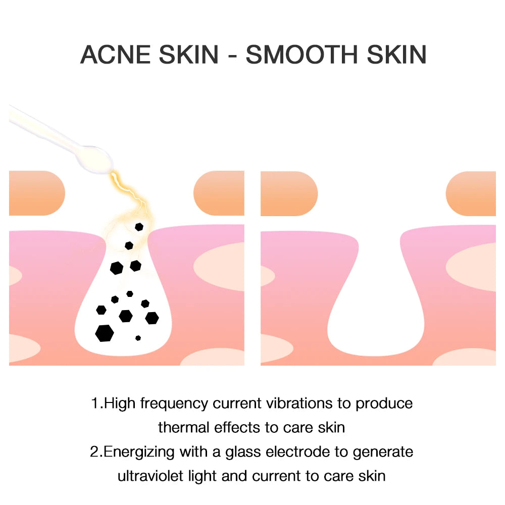 4-in-1 High-Frequency Facial Wand for Acne and Anti-Aging - 13