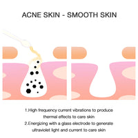 4-in-1 High-Frequency Facial Wand for Acne and Anti-Aging