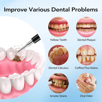 Sonic Electric Teeth Tartar and Plaque Remover