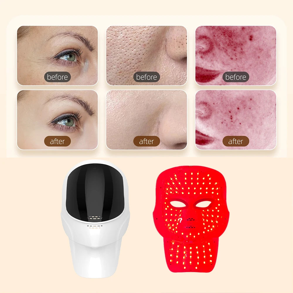 7-Color LED Light Therapy Face and Neck Rejuvenation Mask - 12