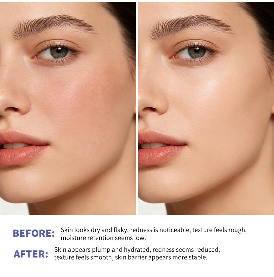 Triple Lipid Peptide Moisturizing Cream for Dry Sensitive Skin - 12