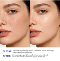 Triple Lipid Peptide Moisturizing Cream for Dry Sensitive Skin