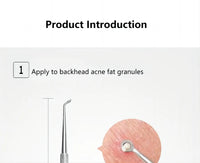 5-Piece Stainless Steel Blackhead and Acne Removal Kit