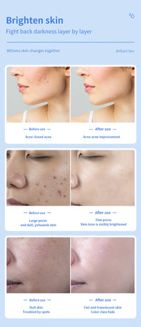 Cold Hammer Facial Cryotherapy & Blue Light Skin Rejuvenation Tool