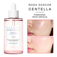 Calming Centella Asiatica Skin Essence for Sensitive & Acne-Prone Skin