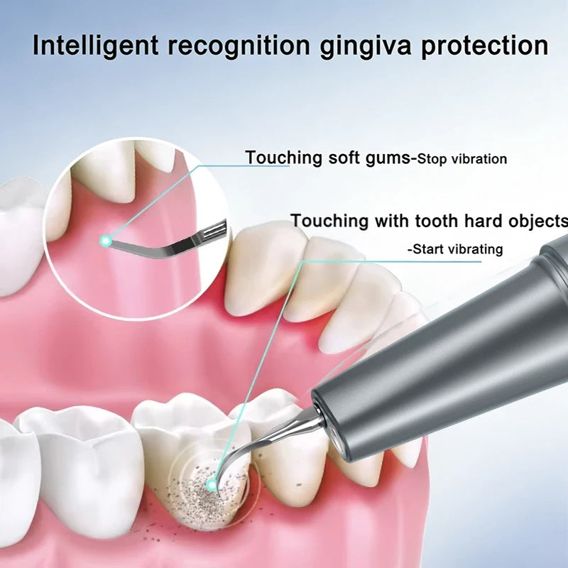 Electric Ultrasonic Teeth Cleaner with HD Camera - 2