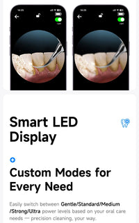 Visible Ultrasonic Teeth Whitening & Plaque Remover