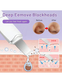 Ultrasonic Facial Skin Scrubber for Deep Pore Cleansing