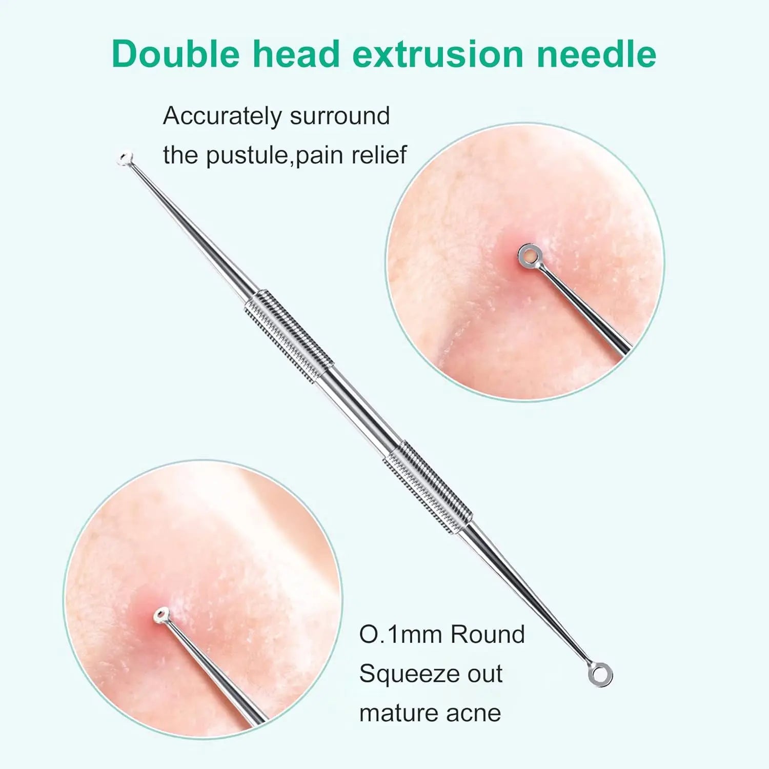 5-Piece Stainless Steel Blackhead and Acne Removal Kit - 3