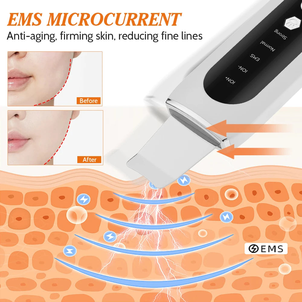 Ultrasonic Facial Skin Scrubber and Pore Cleaner - 11