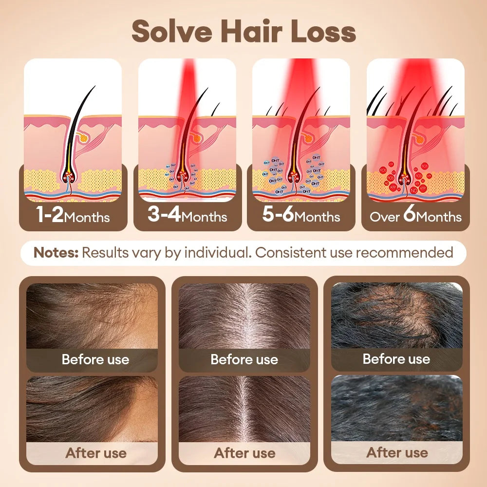 Red Light Therapy Hair Regrowth Cap - 4