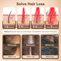 Red Light Therapy Hair Regrowth Cap
