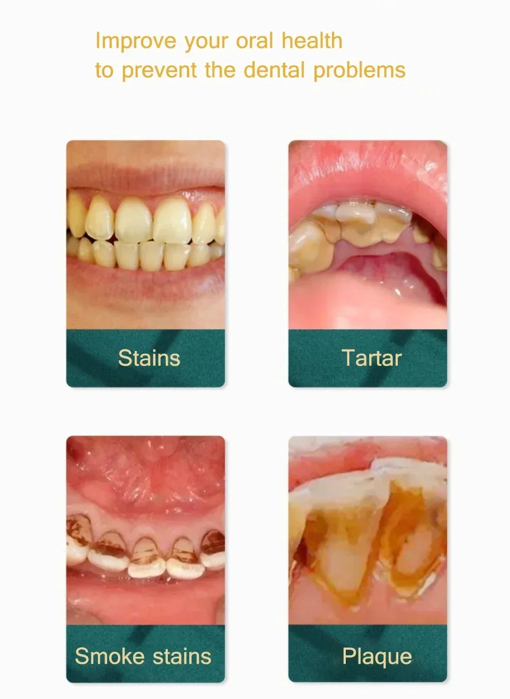 Electric Sonic Teeth Tartar Remover and Plaque Cleaner - 11
