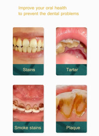 Electric Sonic Teeth Tartar Remover and Plaque Cleaner