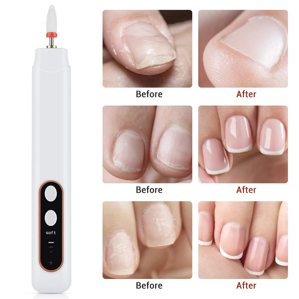 Electric Cordless Nail Drill and Manicure Pedicure File Set - 5