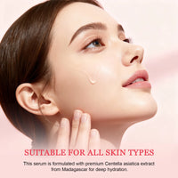 Calming Centella Asiatica Skin Essence for Sensitive & Acne-Prone Skin