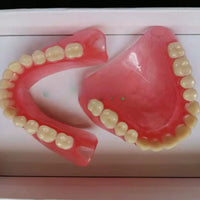 Full Mouth Denture Dental Study Model
