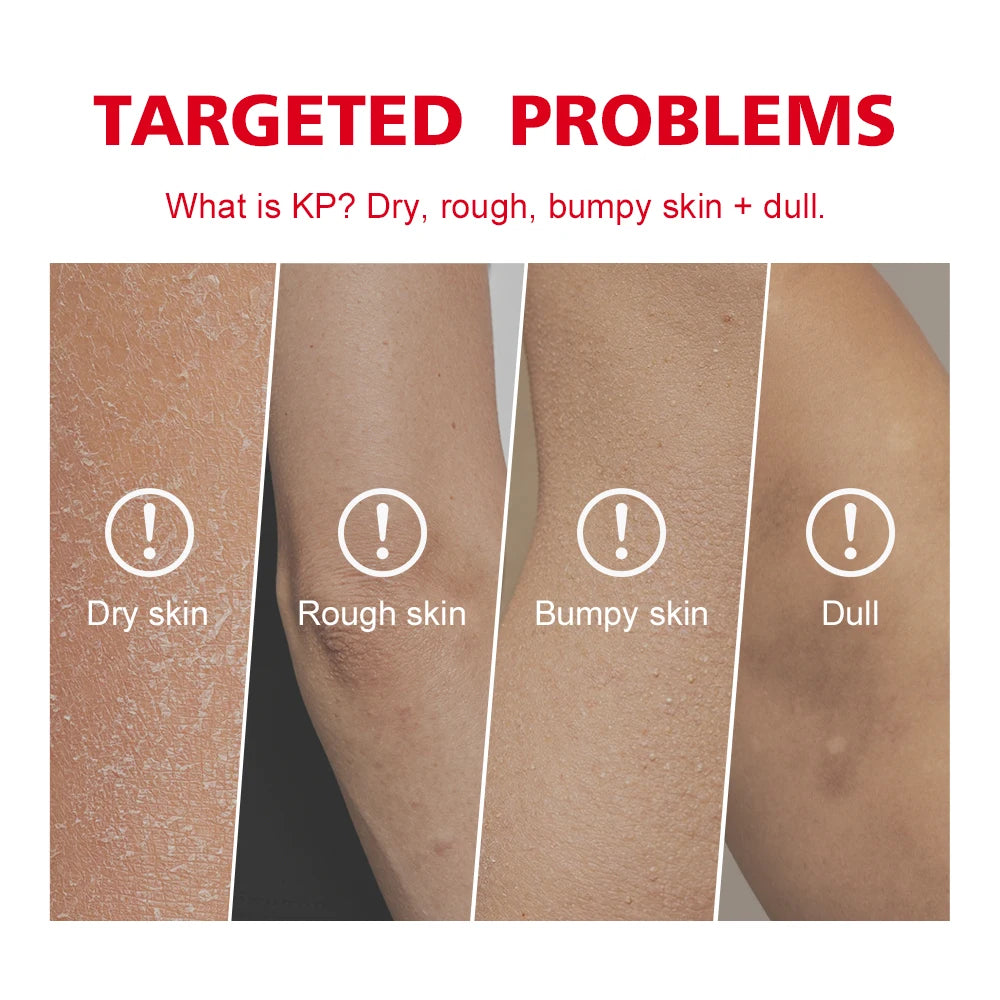 Exfoliating Body Scrub for Keratosis Pilaris and Smooth Skin - 10