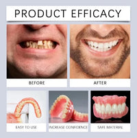 Comfort Fit Cosmetic Smile Veneers