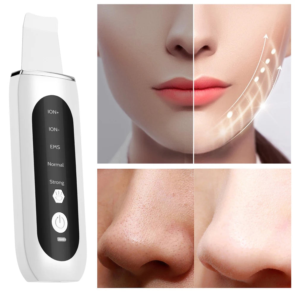 Ultrasonic Facial Skin Scrubber and Pore Cleanser - 11