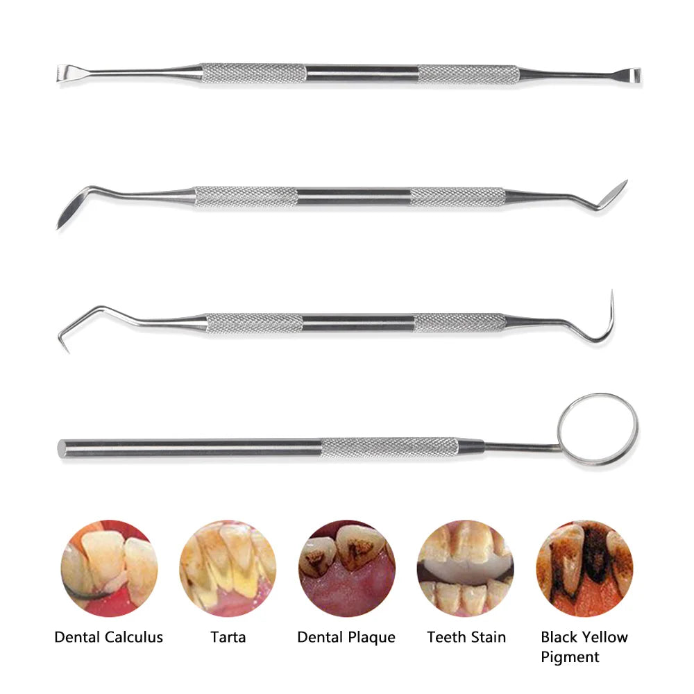 Ultrasonic Teeth Cleaner and Whitening Kit - 25
