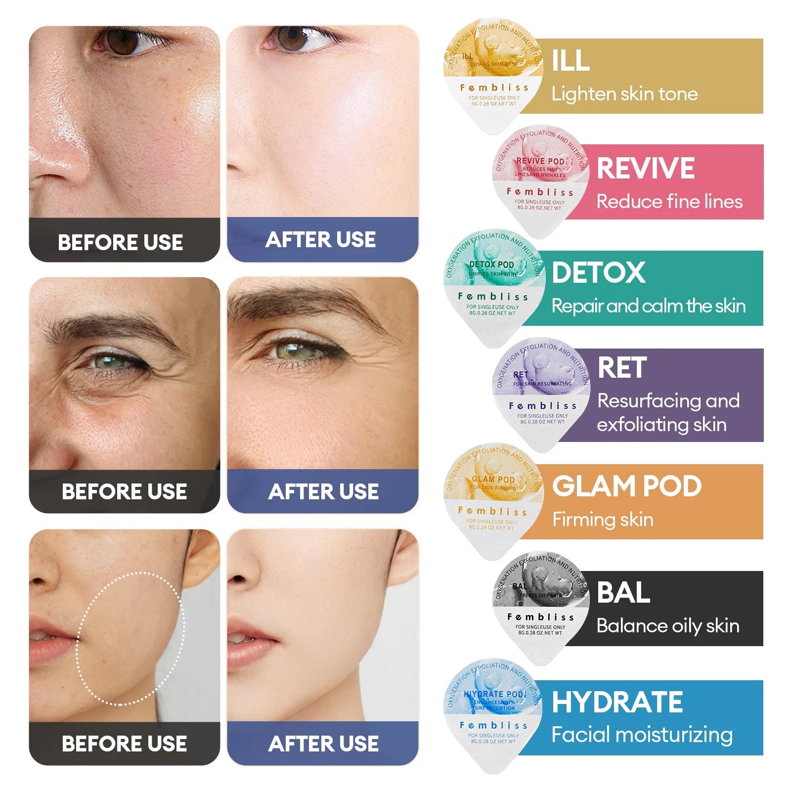 CO2 Oxygen Facial Treatment Capsule and Gel Kit - 12