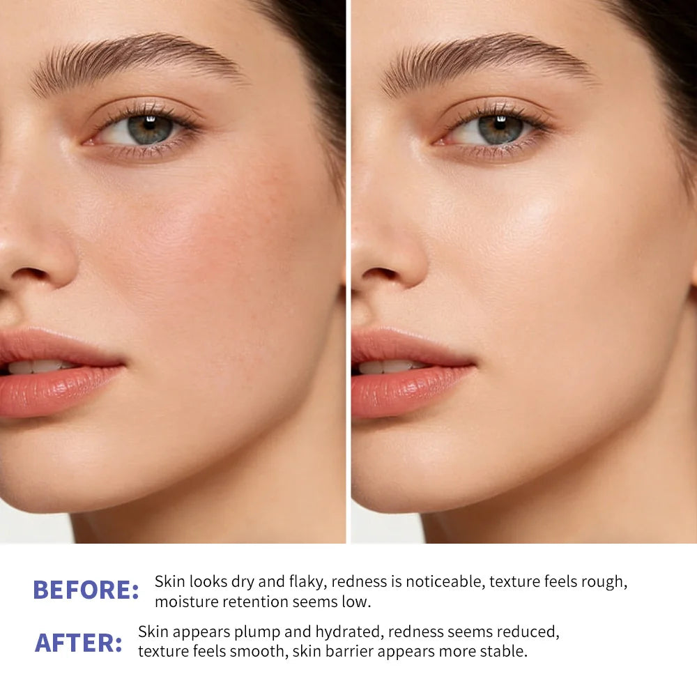 Triple Lipid Peptide Moisturizing Cream for Dry Sensitive Skin - 5