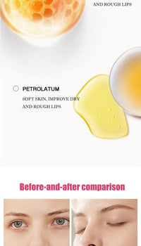 Fruit-Infused Hydrating Lip Balm Set