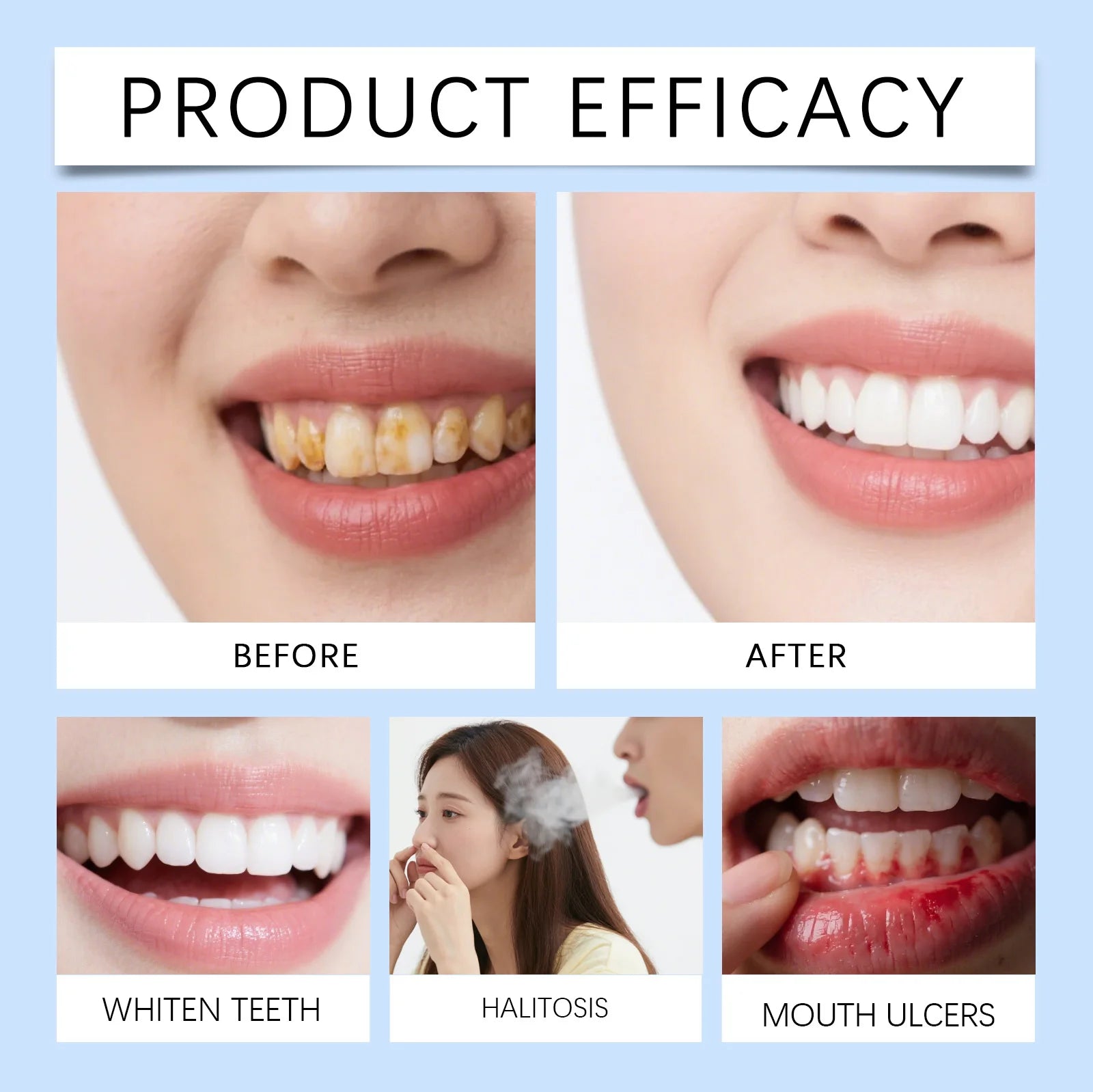 Fast-Dissolving Teeth Whitening and Gum Repair Strips - 4