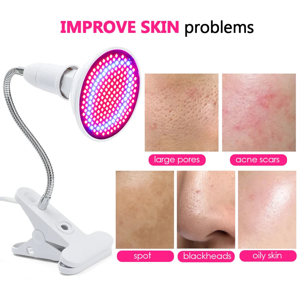 LED Photon Therapy Lamp for Acne and Skin Rejuvenation - 7