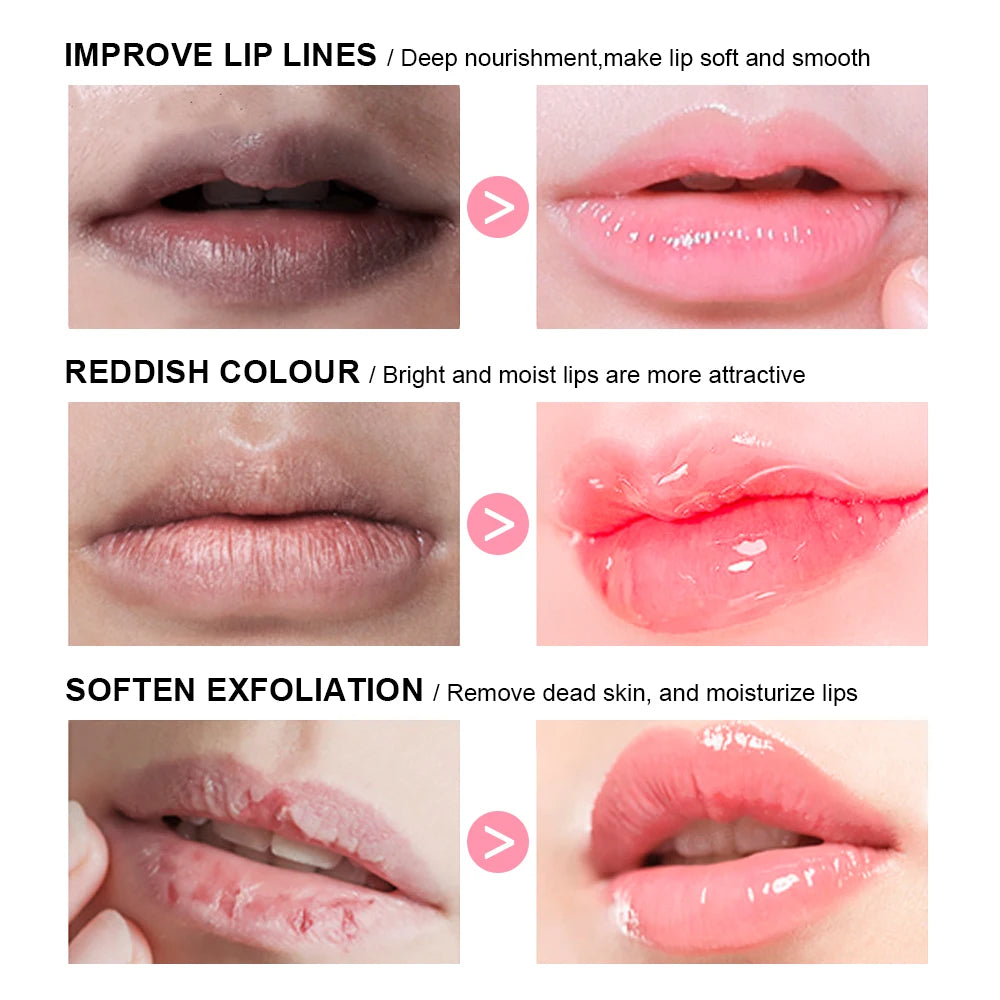 Moisturizing Lip Balm and Sleeping Mask Set for Hydrated Lips - 3