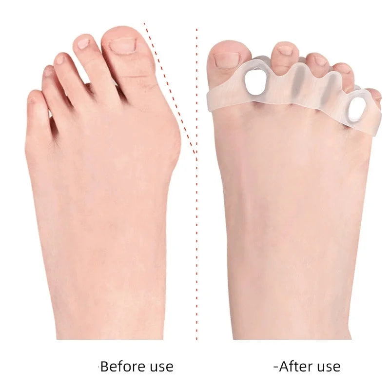 Silicone Orthopedic Gel Toe Separators for Bunion Relief - 4