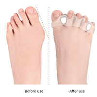 Silicone Orthopedic Gel Toe Separators for Bunion Relief