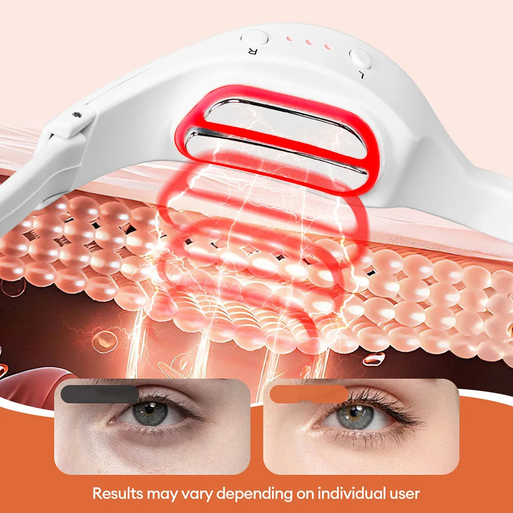 3D Red Light Eye Massager for Eye Strain and Fatigue - 21