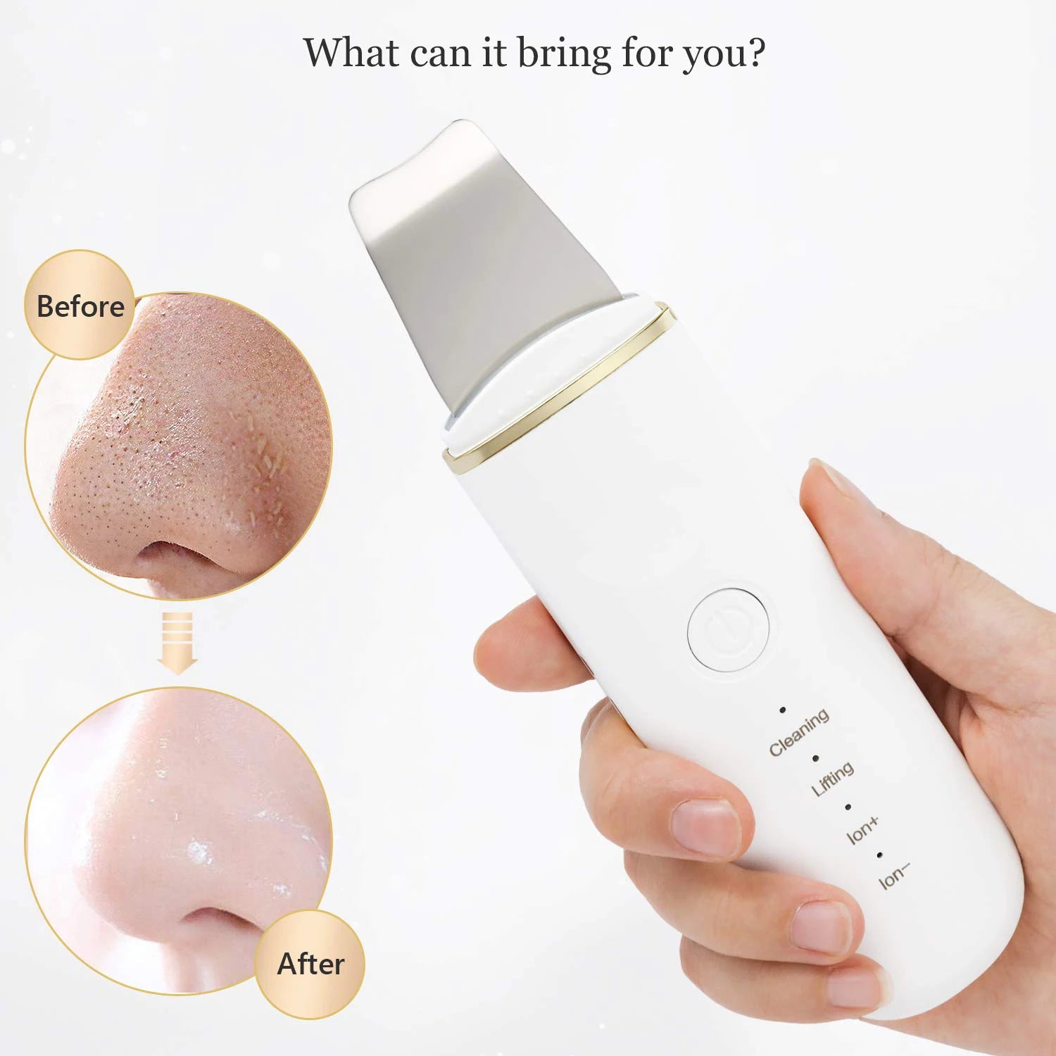 Ultrasonic Facial Skin Scrubber and Pore Cleaner - 4