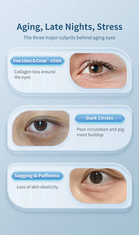 Heated Eye Massage Wand for Dark Circles and Puffiness